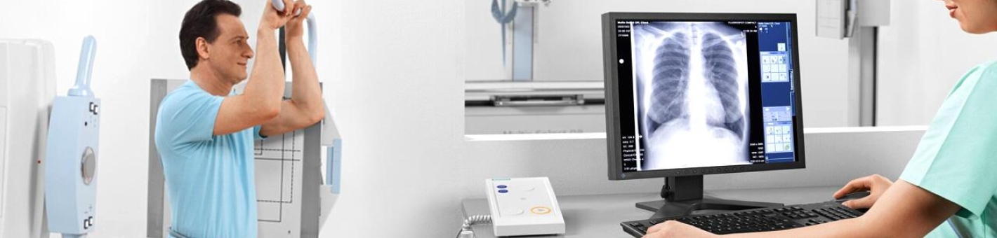 Цифровая рентгенография грудной клетки или флюорография? Как сделать правильный выбор